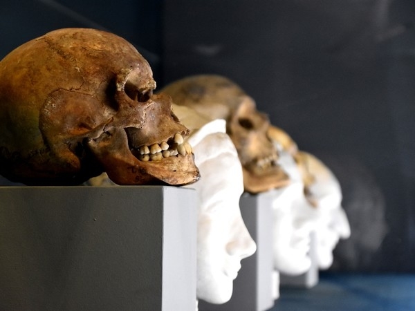 fd751459bb160ddea7151d8faaaa5b2c