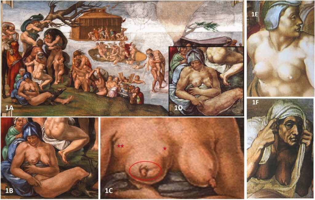 Michelangelo: una donna con il cancro al seno nel Giudizio Universale?